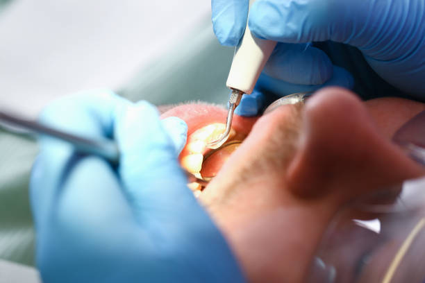 Best Emergency Tooth Extraction  in Lacey, WA